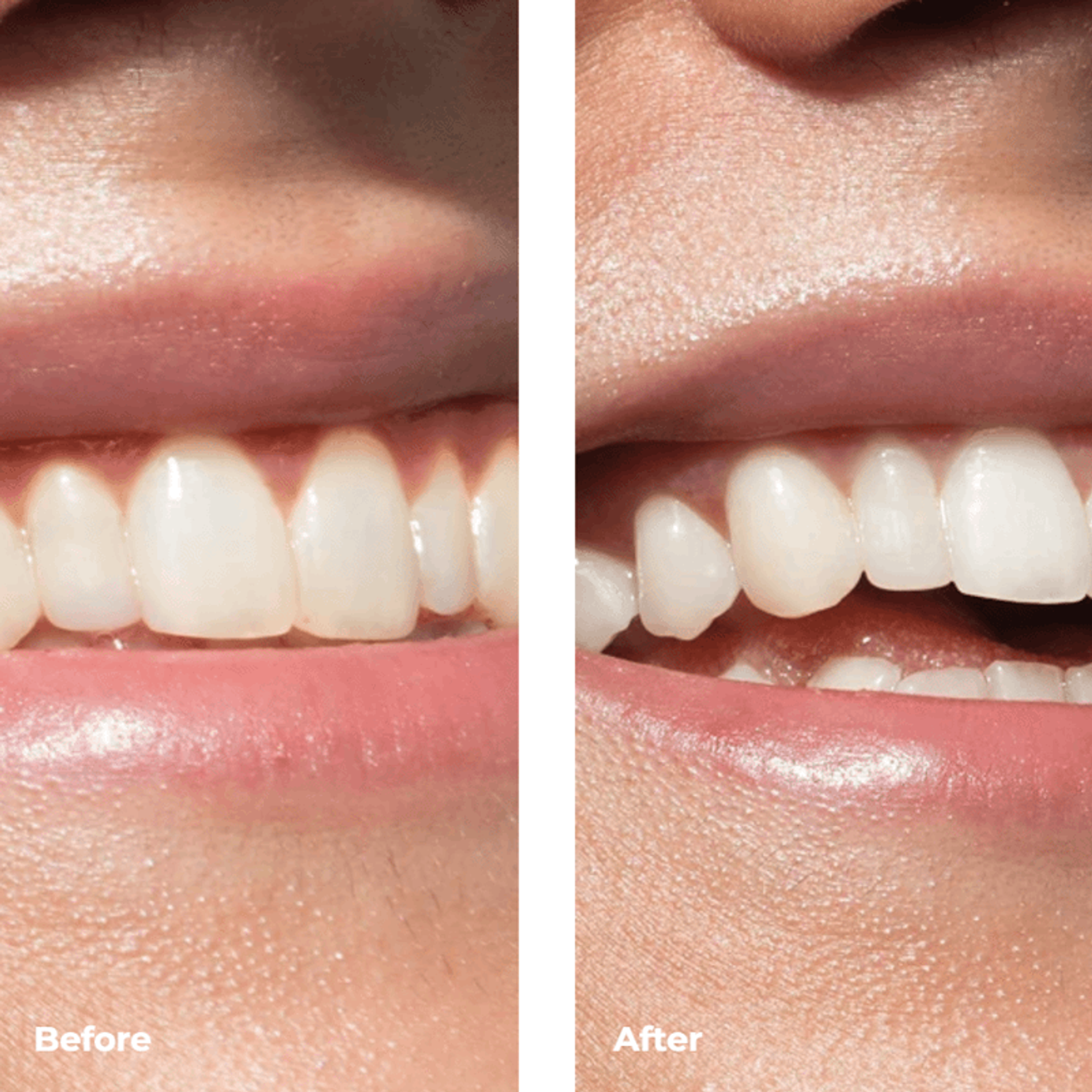 ISSA™4 Smile Hybrid Sonic Toothbrush
