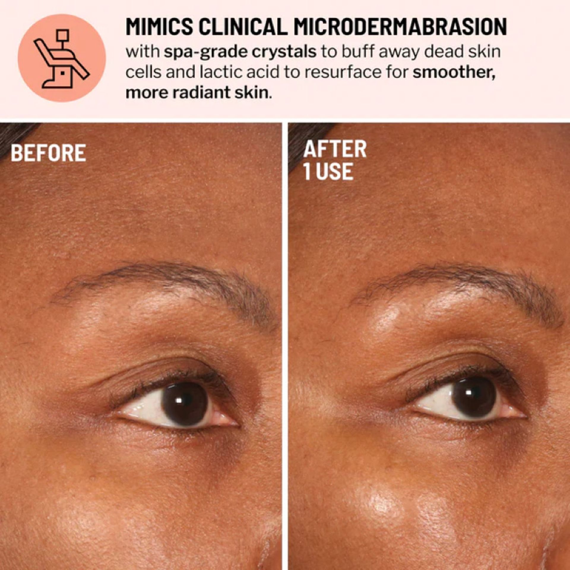 Advanced Microdermabrasion Face Exfoliator