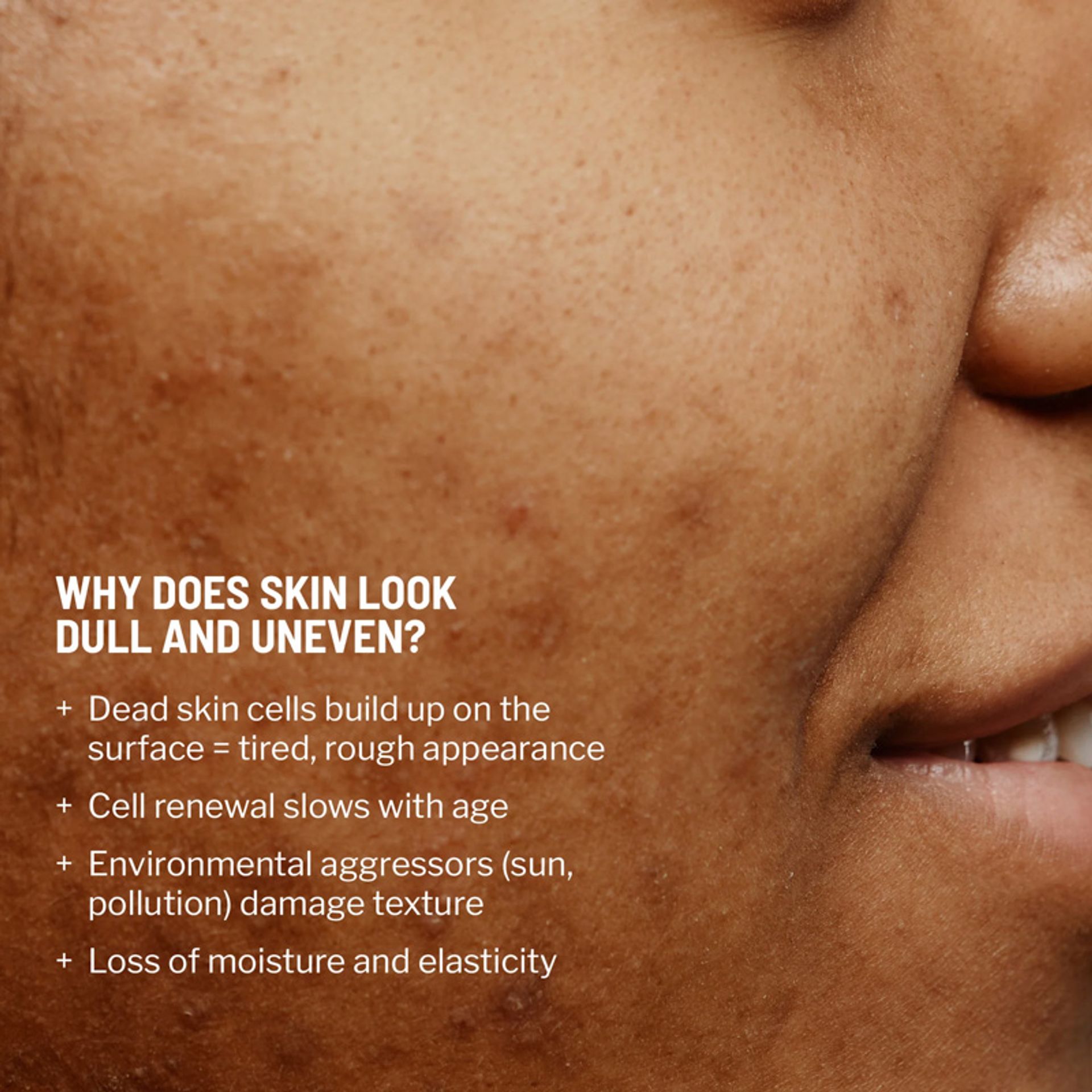 Advanced Microdermabrasion Face Exfoliator